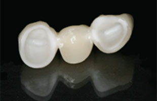 Ceramic crowns