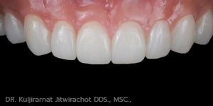 ออกแบบรอยยิ้ม